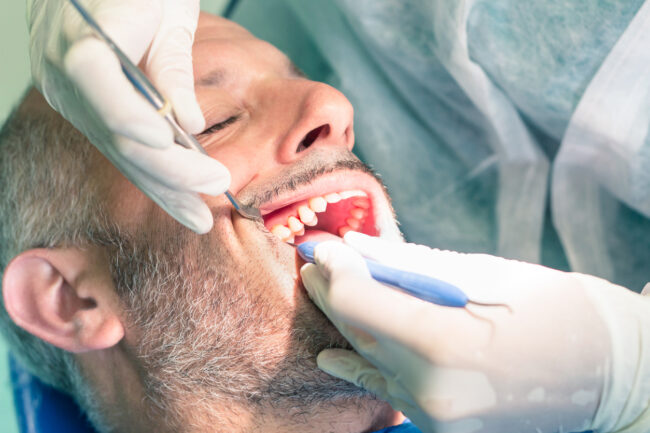 Especialista evaluando una regeneración ósea dental